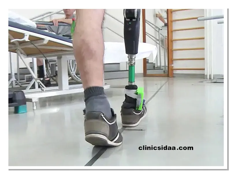 پروتز پا چیست؟ معرفی کامل، کاربردها و نکات کلیدی 3 عملکرد پروتز پا چگونه است