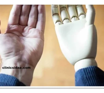 پروتز مچ دست