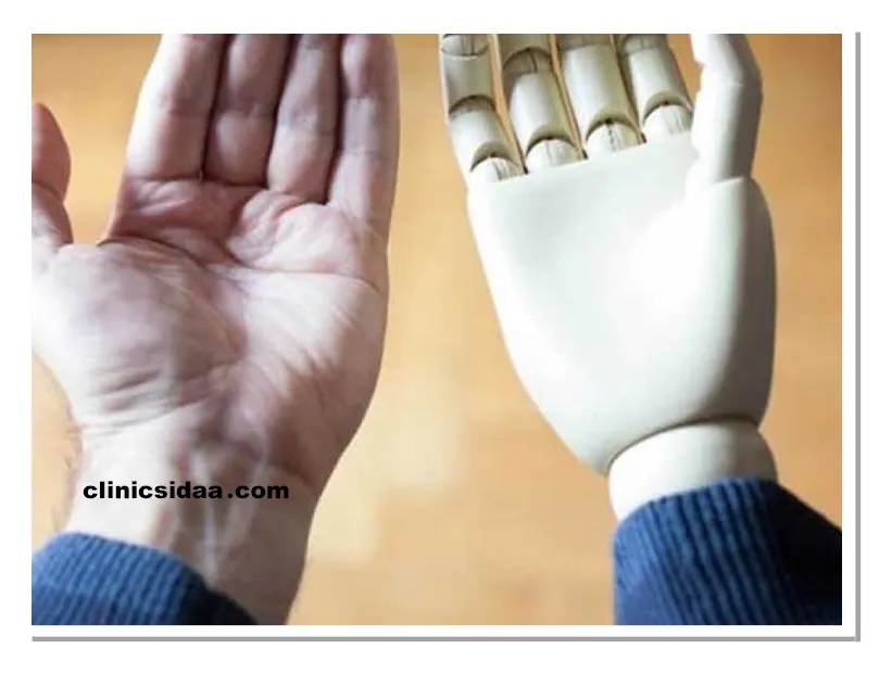 پروتز مچ دست