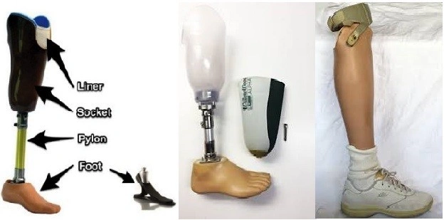 قیمت پروتز پا زیر زانو - 1404 3 قیمت ساخت پروتز سیلیکونی پا زیر زانو