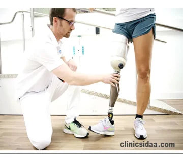 پروتز بالای زانو