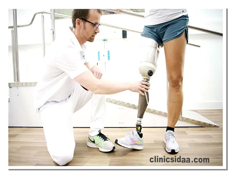 پروتز بالای زانو