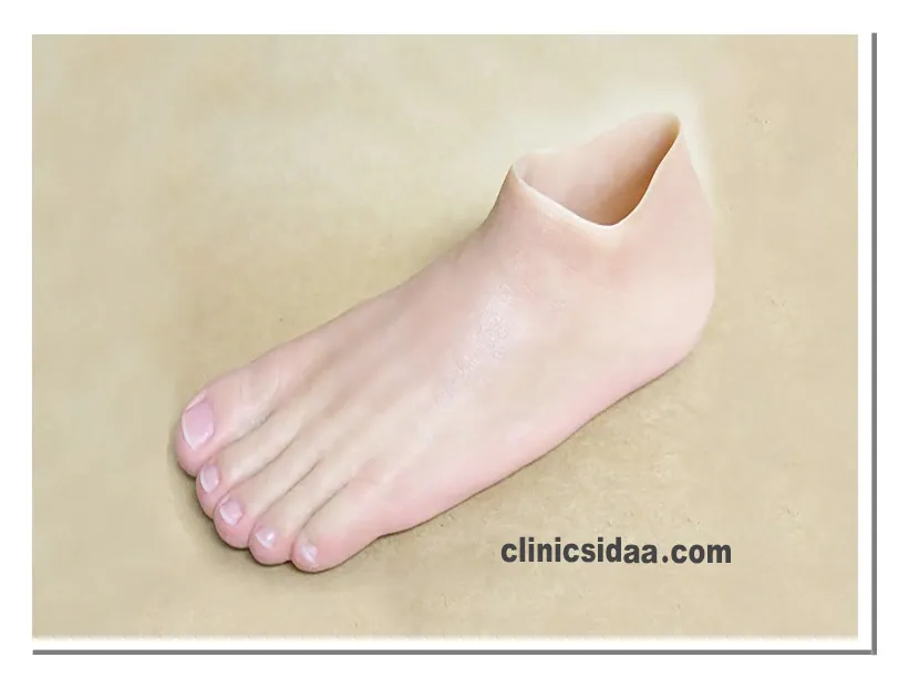 ساخت پروتز مچ پا مصنوعی