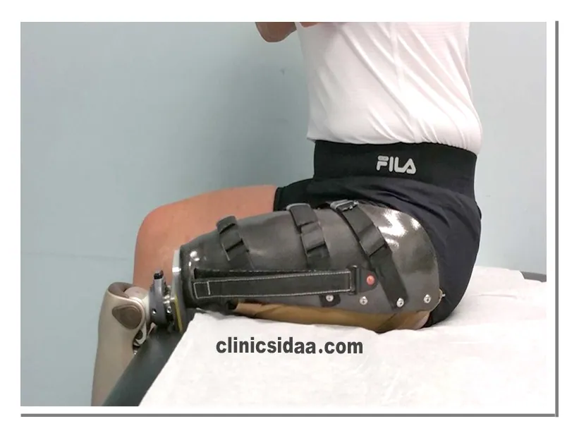 Care of above knee prostheses