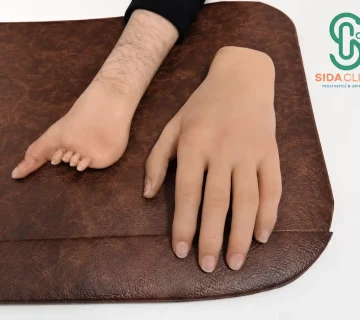 بهترین مرکز پروتز دست