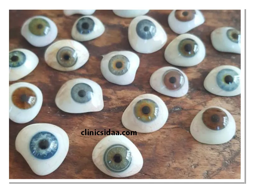 لیست قیمت پروتز چشم مصنوعی 1 قیمت پروتز چشم