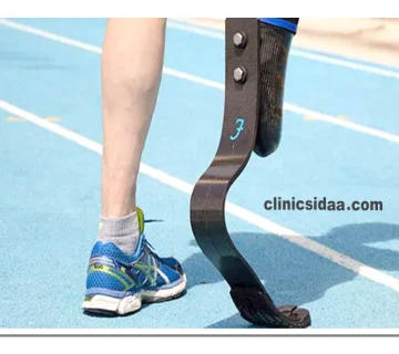 بهترین مرکز پروتز پا