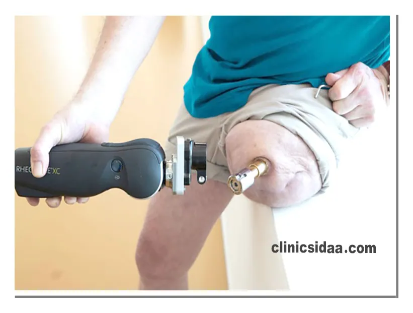 مراحل ساخت پروتز پا بالای زانو