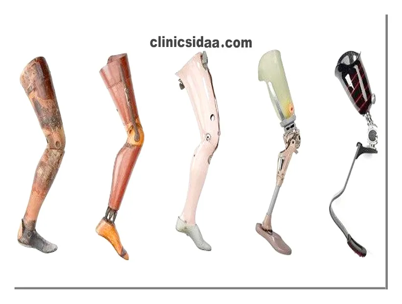 در کلینیک ساخت پروتز پا چه خدماتی ارائه می شود