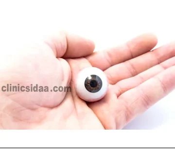 عوارض پروتز چشم