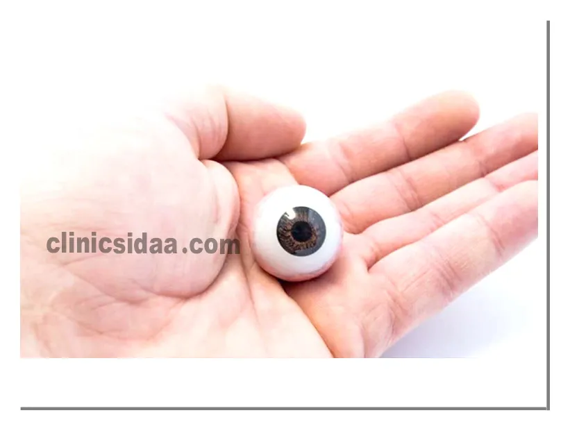 عوارض پروتز چشم