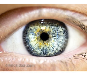 انواع پروتزهای چشم