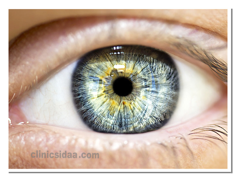 معرفی انواع پروتزهای چشم و کاربردهای آنها + راهنمای انتخاب مناسب 1 انواع پروتزهای چشم