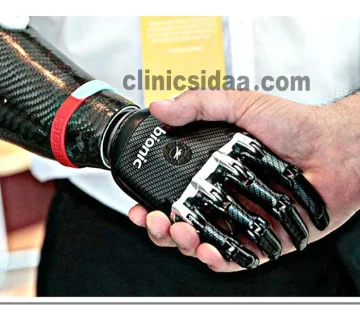 جدیدترین پروتز دست در ایران