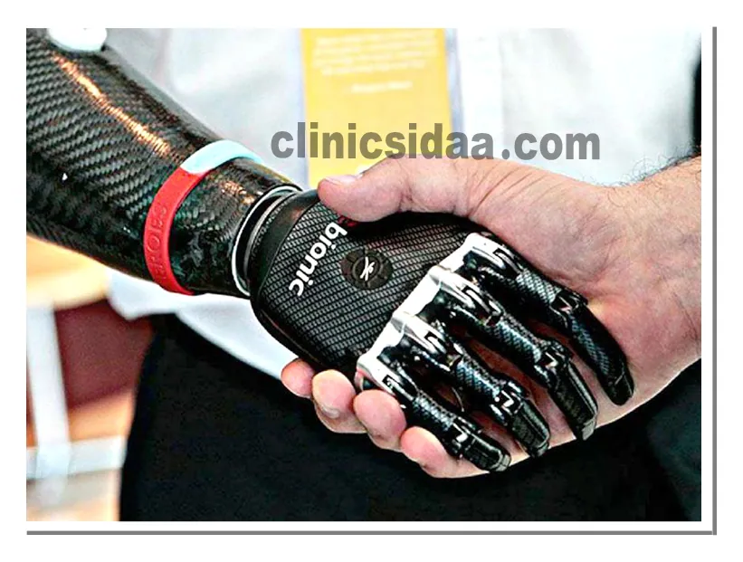 جدیدترین پروتز دست در ایران