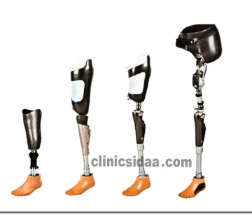 نگهداری پروتز زانو