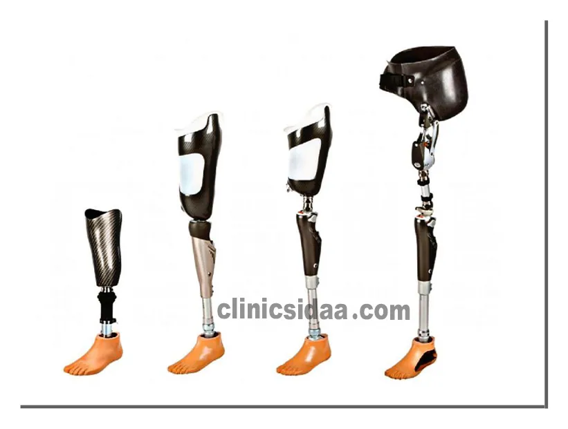 نگهداری پروتز زانو