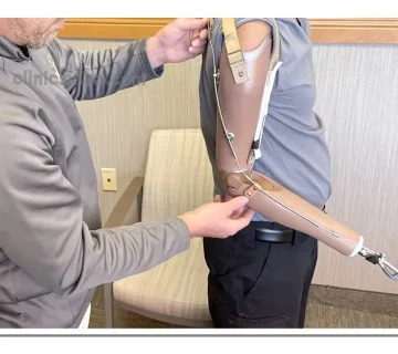 انواع پروتز بالای آرنج