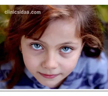 همه چیز در مورد پروتز چشم برای کودکان 5 پروتز چشم برای کودکان