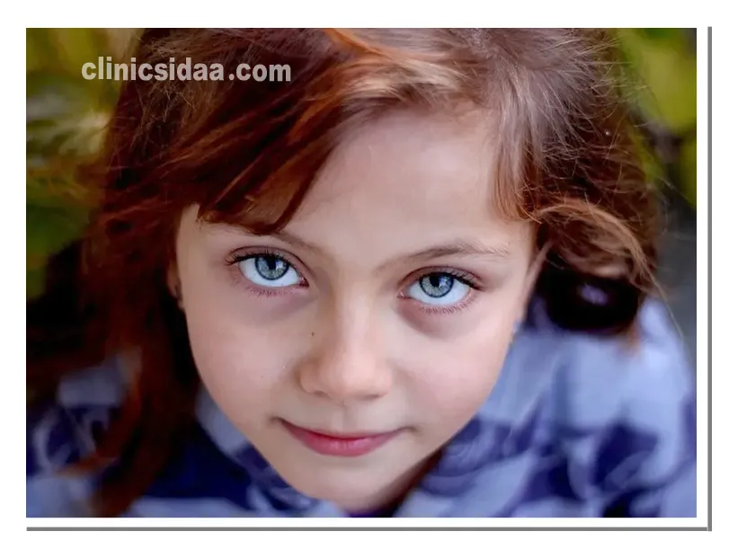 پروتز چشم برای کودکان