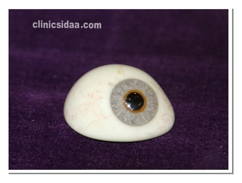 پروتز چشم بدون تخلیه