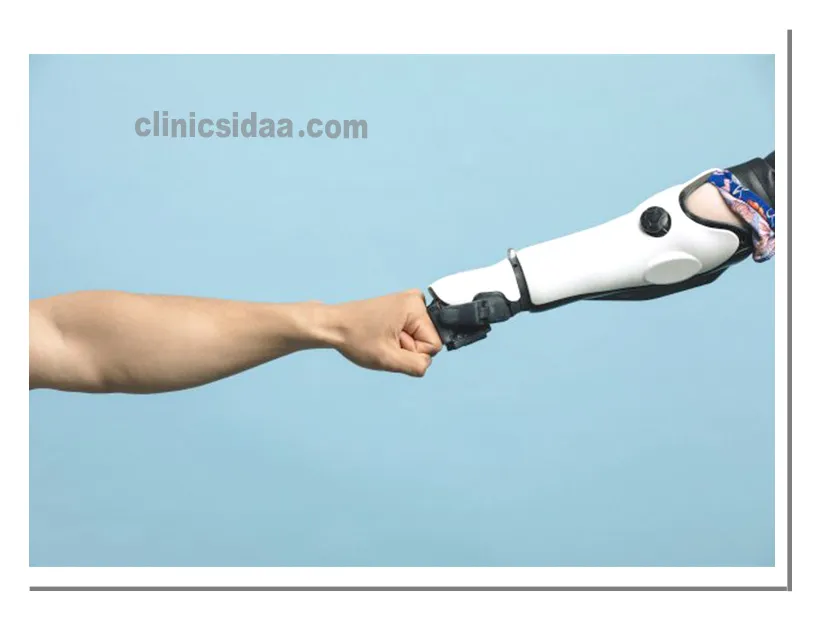 انواع پروتز زیر آرنج