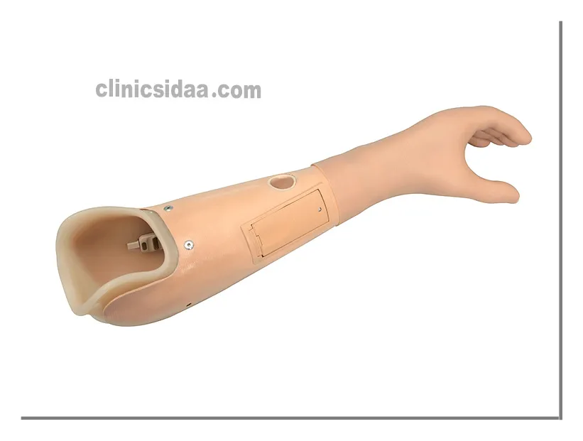 arm prosthesis