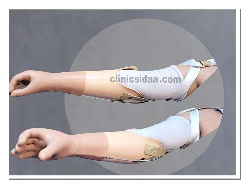 arm prosthesis