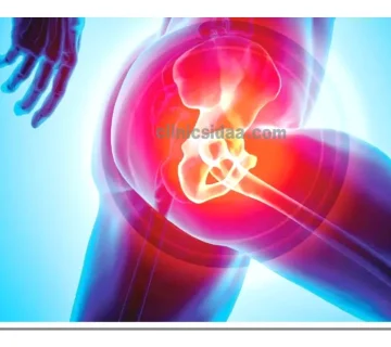 عفونت پروتز لگن