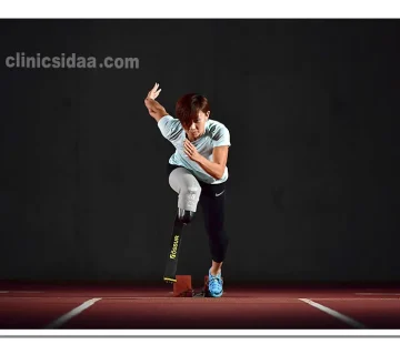 پروتز ورزشی