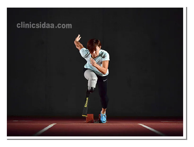 پروتز ورزشی چیست (آشنایی با پروتزهای مناسب فعالیتهای ورزشی) 1 پروتز ورزشی