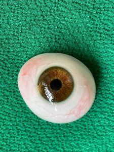 نقش پروتز چشم در حفظ عملکرد طبیعی صورت