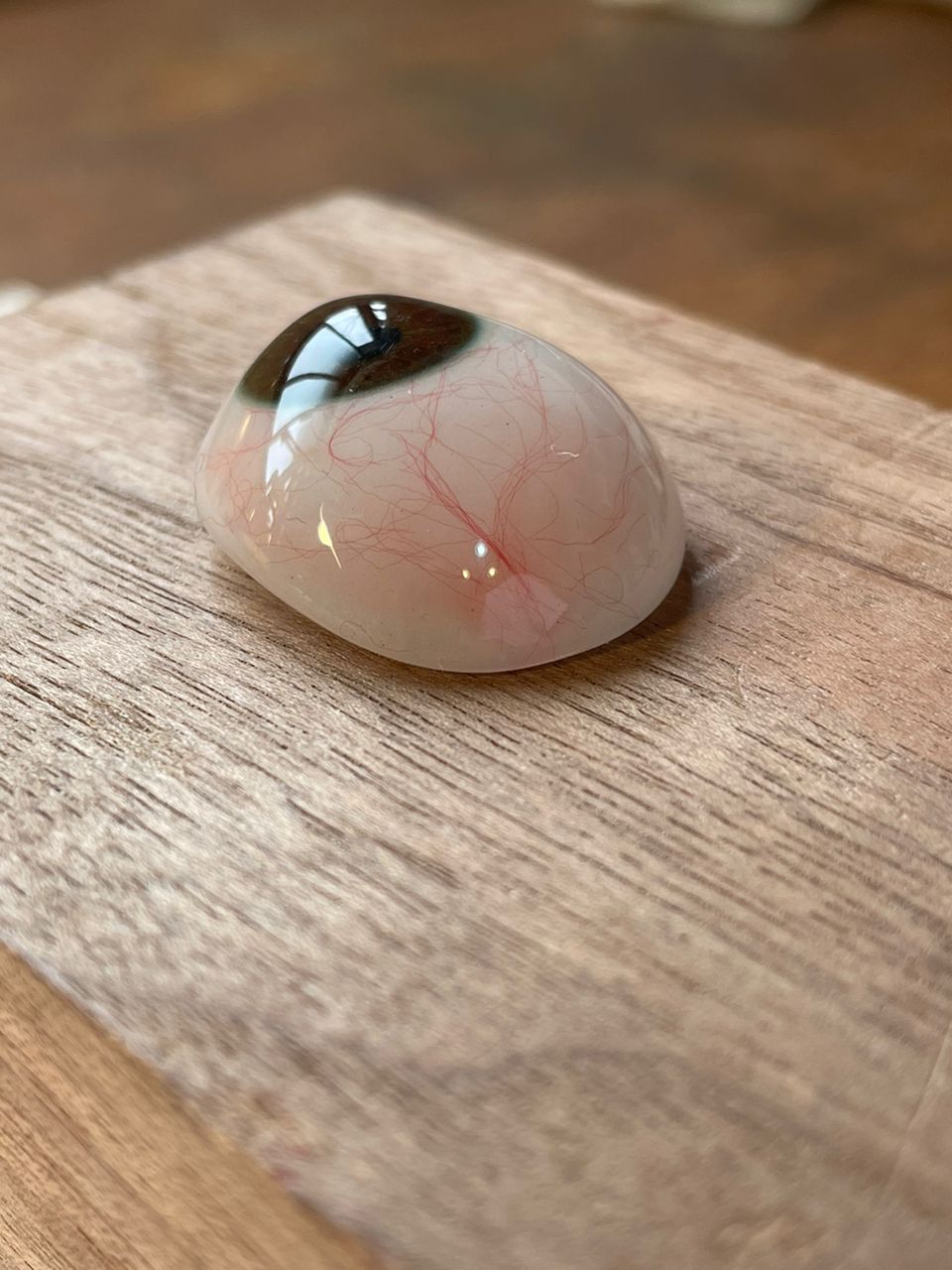 تأثیر پروتز چشم بر کیفیت زندگی بیماران