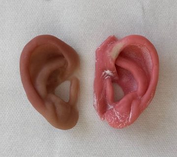 پروتز گوش برای نوزادان