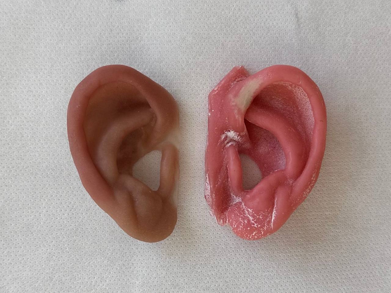 پروتز گوش برای نوزادان