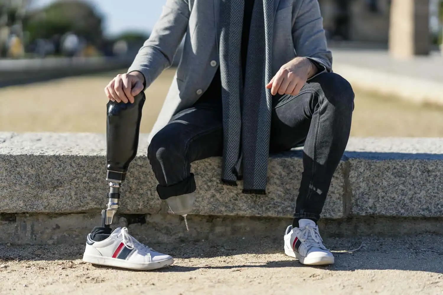 کلینیک سیدا 7 closeup shot disabled young man with foot prosthesis sitting outdoor 665346 169178 2