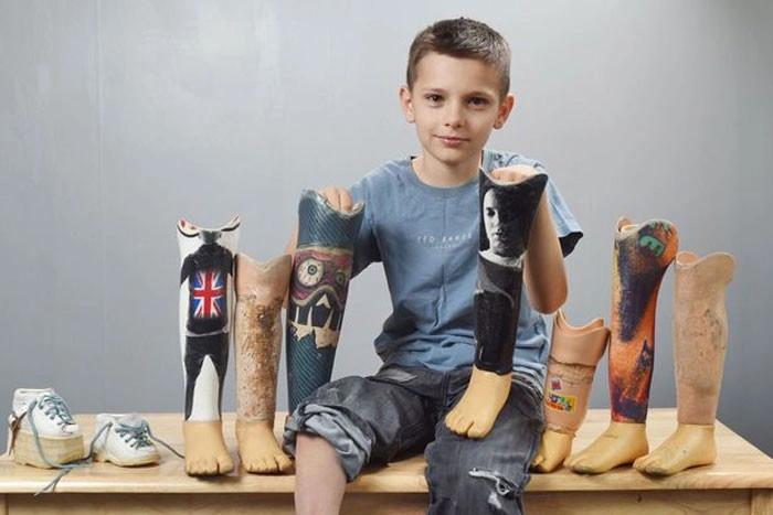 پروتز سیلیکونی پا برای کودکان: همه چیز درباره مزایا و کاربردها 2 بهترین مرکز پروتز پا سیلیکونی کودکان