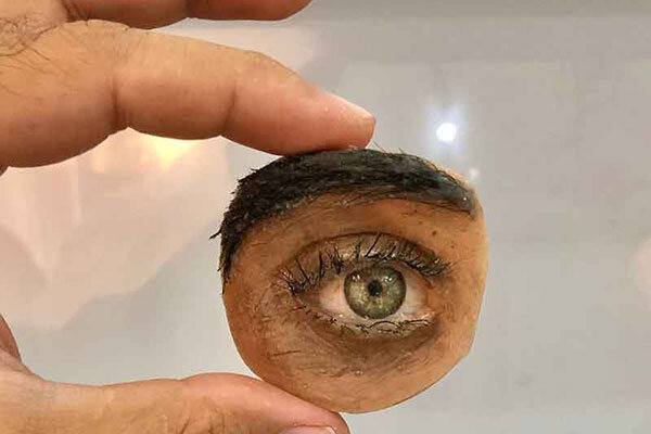 پروتز چشم برای سالمندان