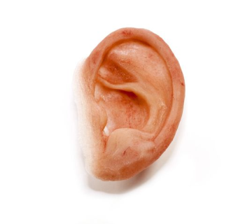 انواع پروتز گوش