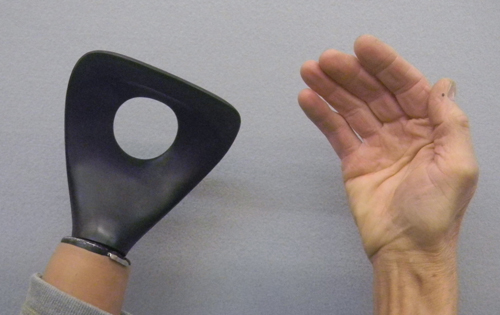 پروتز سیلیکونی دست برای والیبال