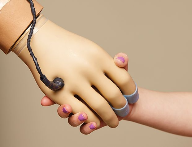 انجام پروتز دست برای قطع عضو پس از حادثه انفجار: راهنمای جامع انتخاب و بازتوانی 1 پروتز دست برای قطع عضو