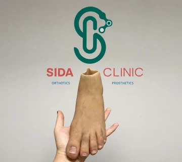 نمونه پروتز پا ساخته‌شده در کلینیک سیدا