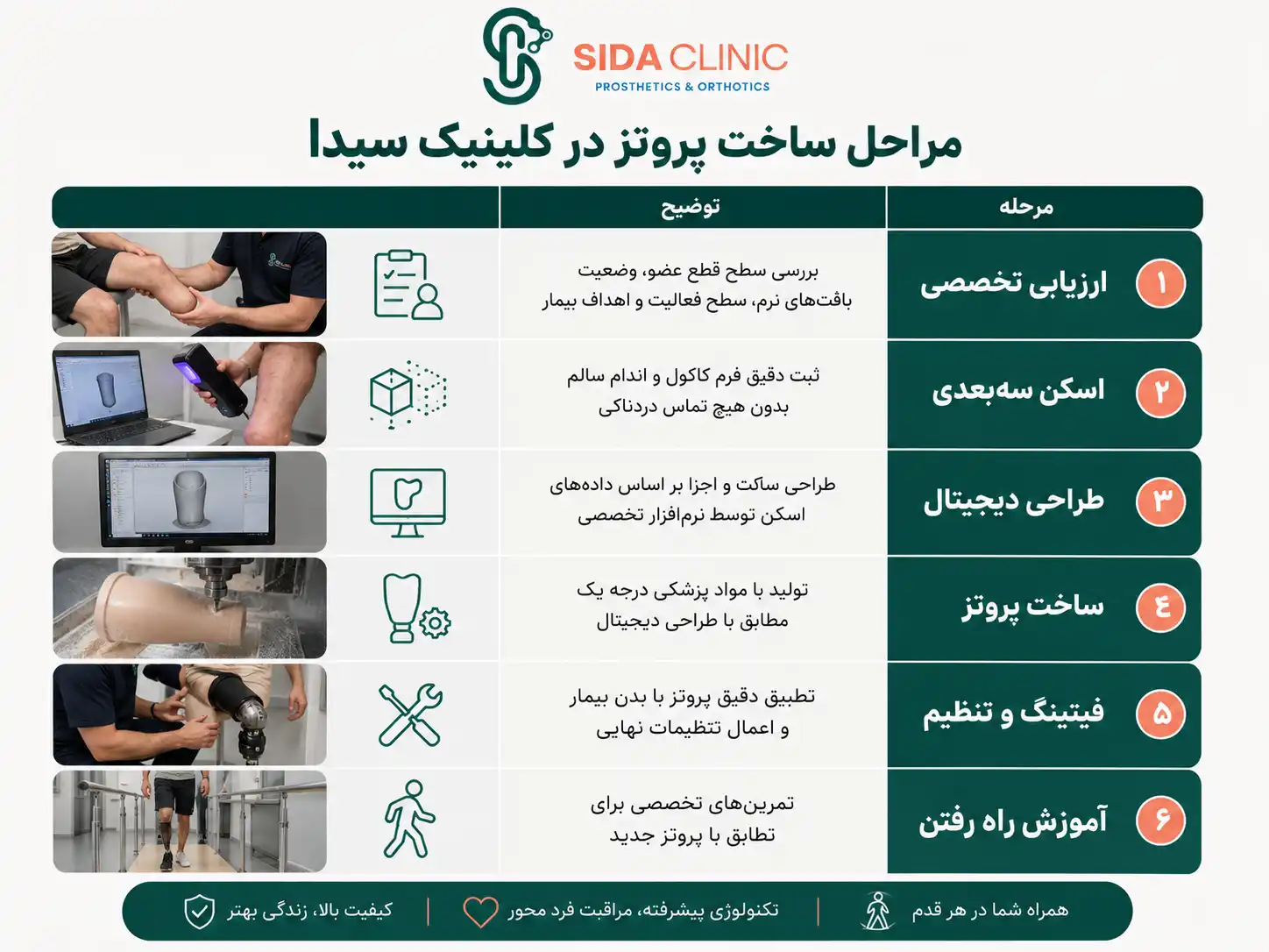 پروتز پا مصنوعی: راهنمای کامل انواع، قیمت و انتخاب در ۱۴۰۵ 6 مراحل ساخت پروتز پا در کلینیک سیدا: