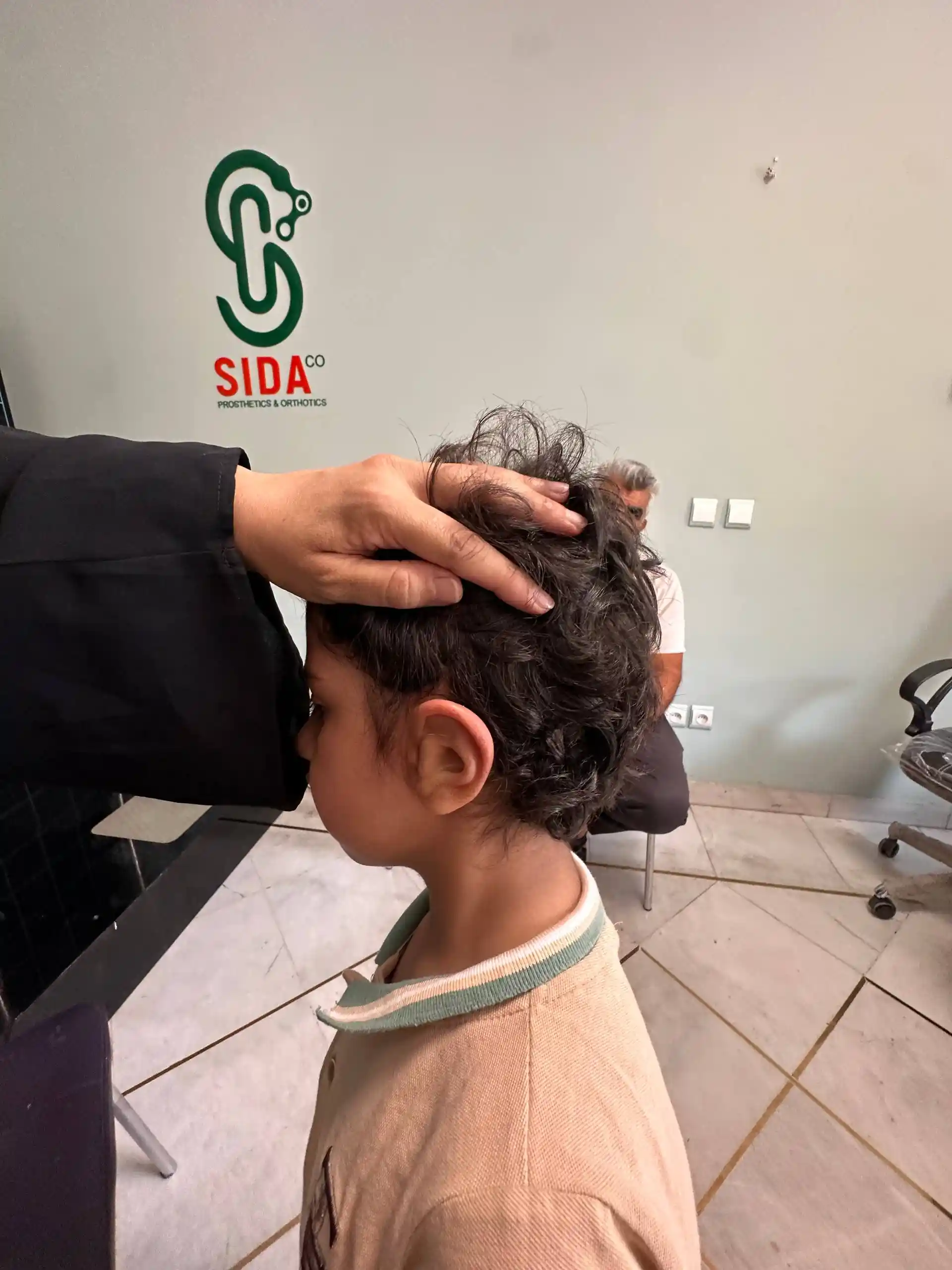 نمونه دوم قبل و بعد پروتز گوش سیلیکونی