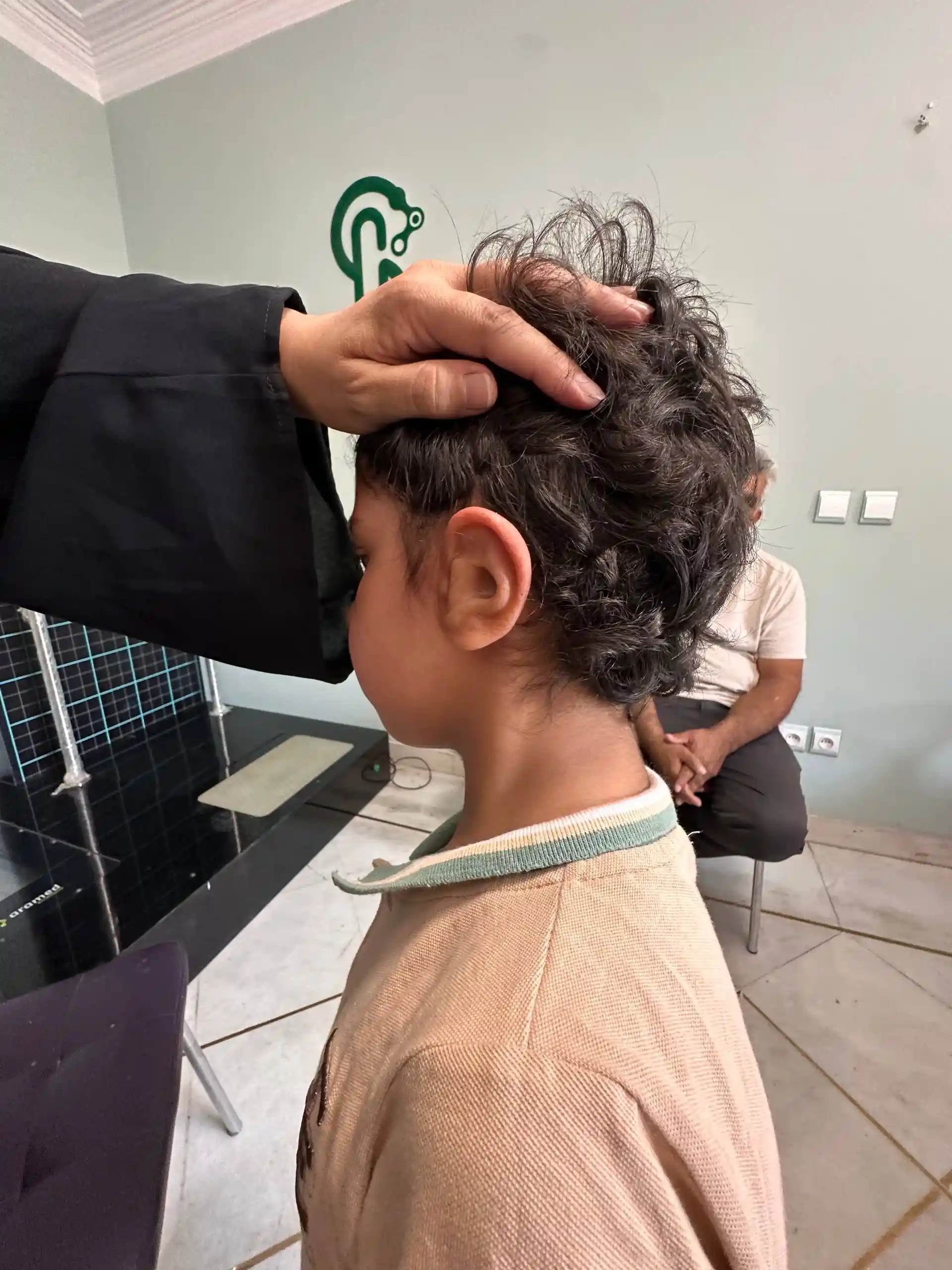نمونه چهارم قبل و بعد پروتز گوش سیلیکونی