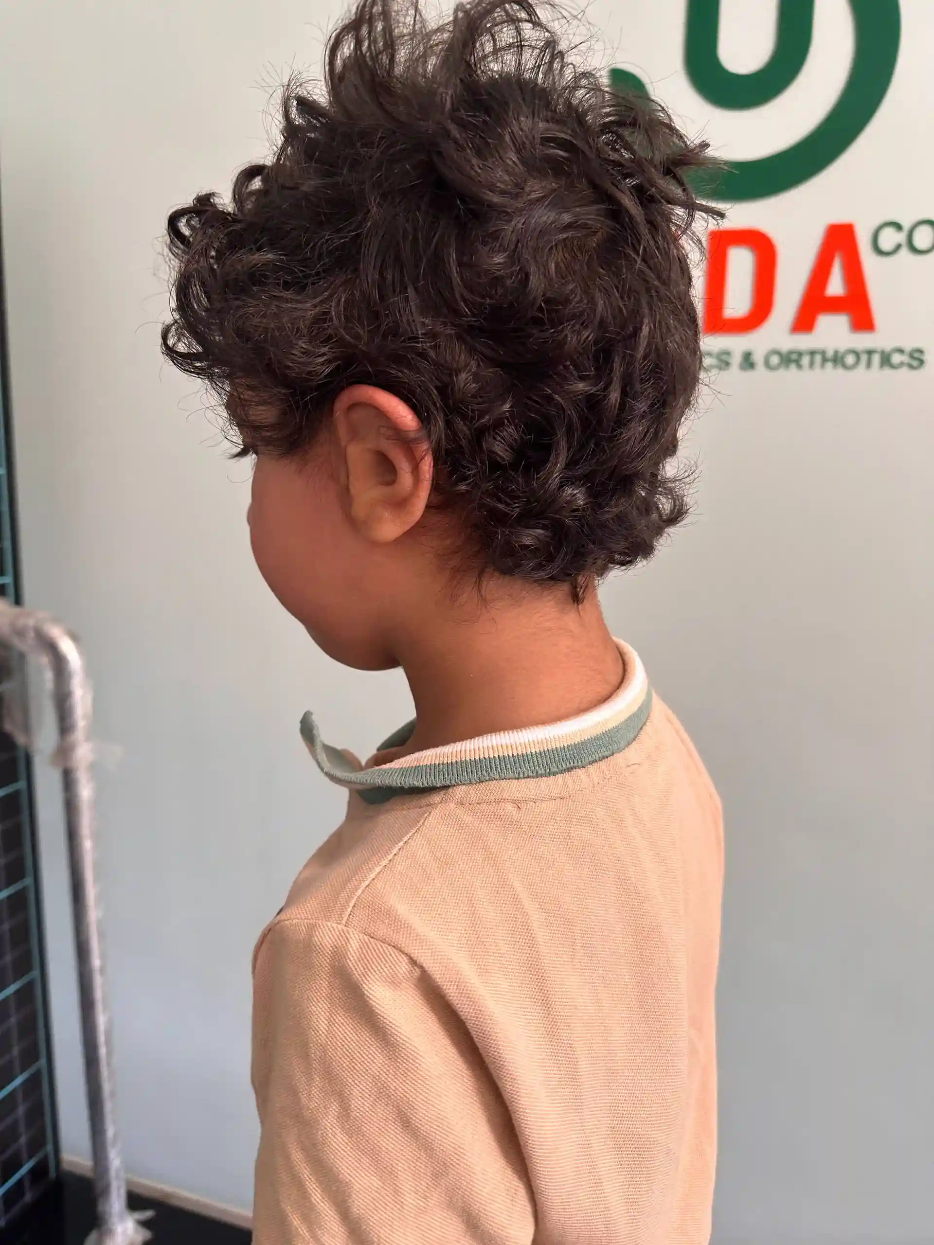نمونه سوم قبل و بعد پروتز گوش سیلیکونی
